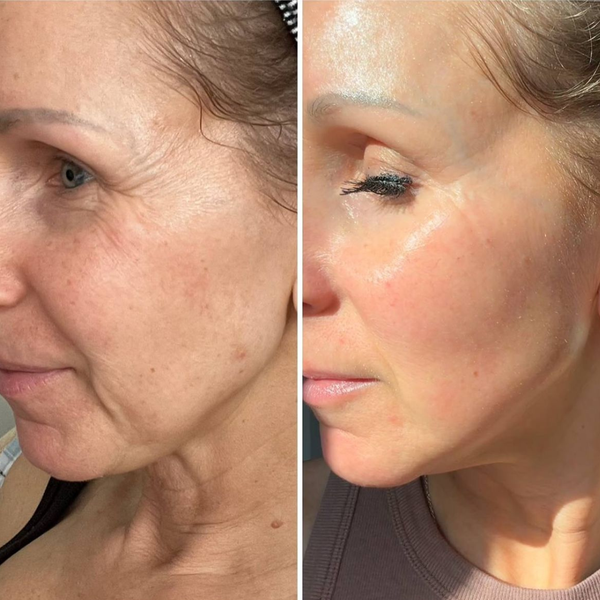 3. Packed with anti-aging actives your skin loves